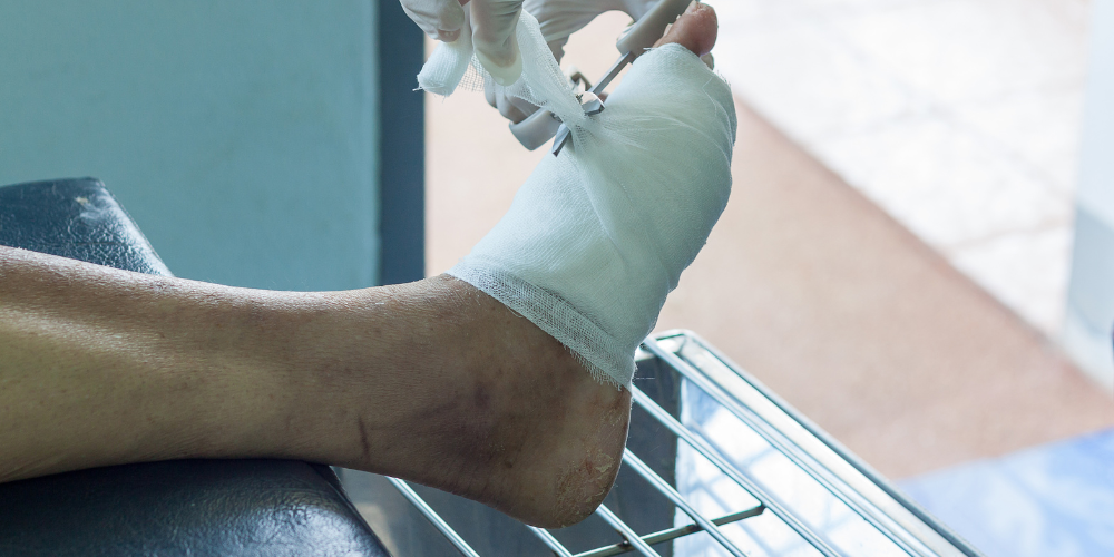 Comprehensive Diabetic Foot Care: Ensuring Healthy Steps Ahead